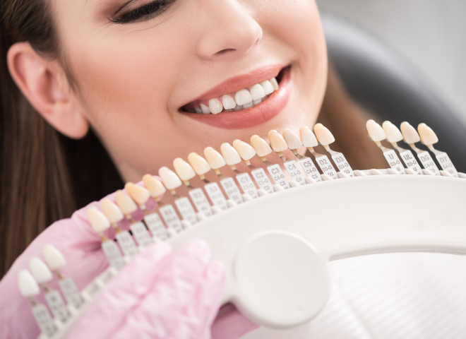 Choix de la teinte des dents à l'aide d'un nuancier