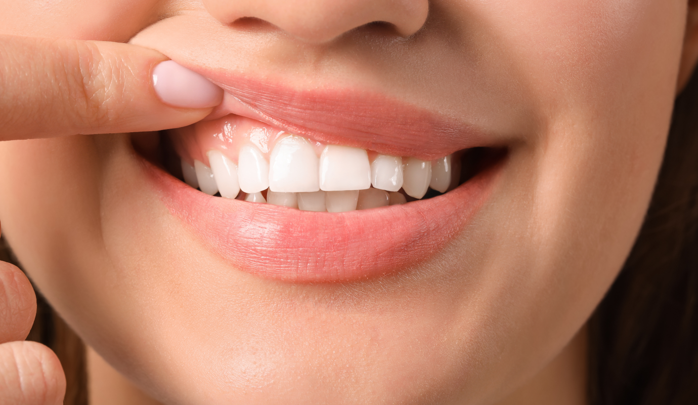 Gros plan sur des dents blanches et bien alignées