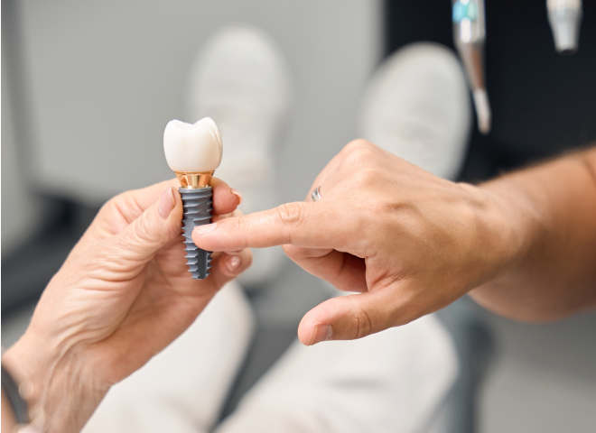Modèle d'implant dentaire tenu à la main pour explication