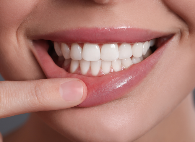 Gros plan sur un sourire blanc et lumineux