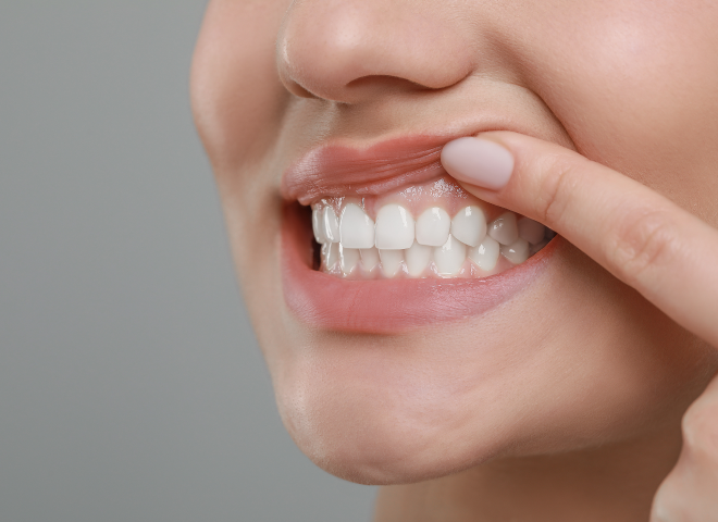 Gros plan sur un sourire aux dents parfaitement alignées