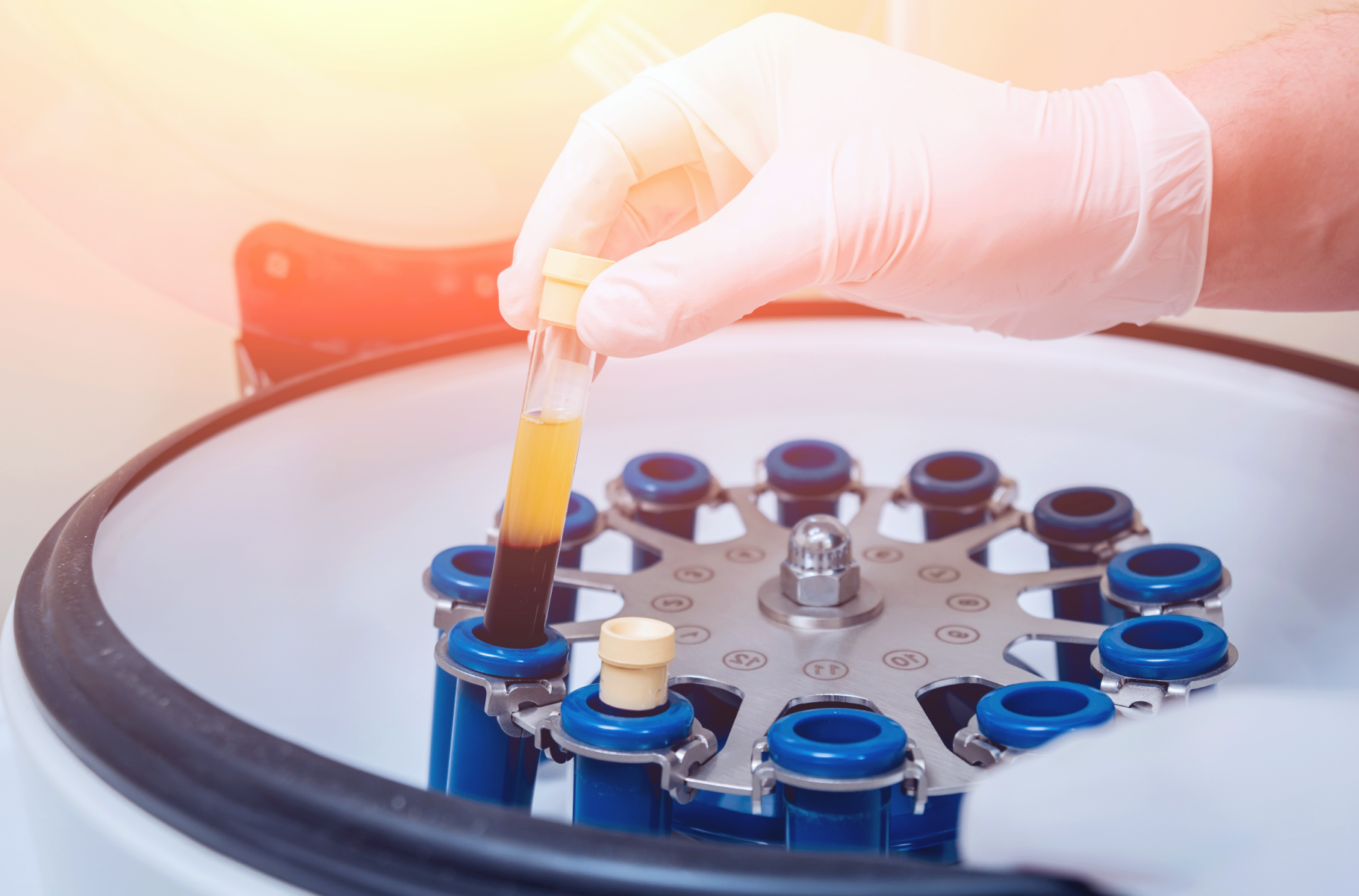 Tube de sang dans une centrifugeuse pour la préparation du PRF